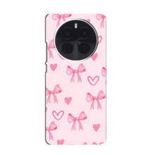 Чохли для смартфона OnePlus Ace 5 Pro