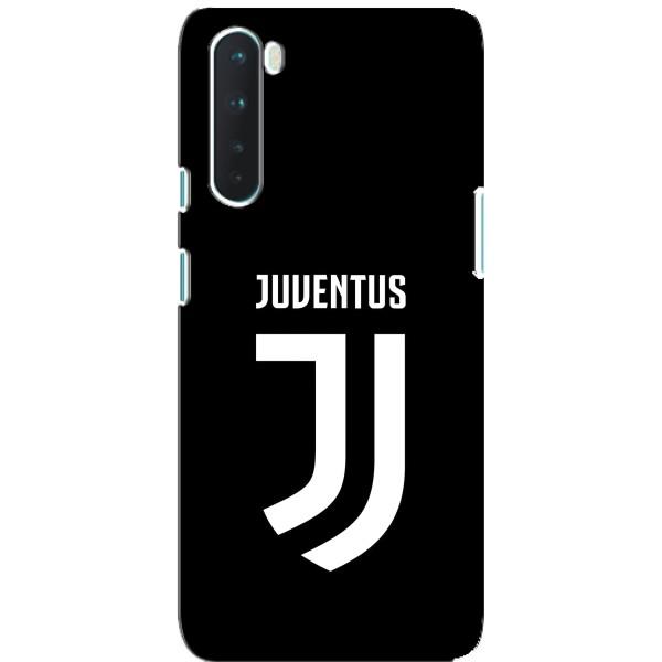 Чохли для OnePlus Nord (VPrint) - Футбольні клуби – ФК Ювентус