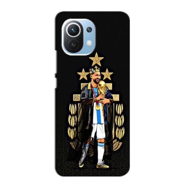 Чохли для Xiaomi Mi 11 Lite (Leo чемпіон) (AlphaPrint) – Мессі Король
