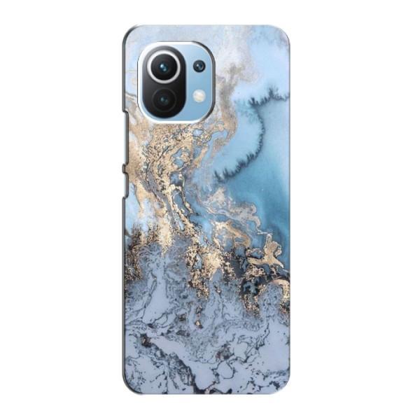 Мраморный чехол на Xiaomi Mi 11 Lite (VPrint) – Нежный мрамор