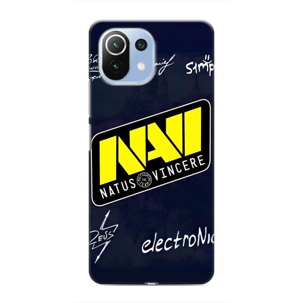 Чохол КІБЕРСПОРТ для Xiaomi Mi 11 Lite – NAVI