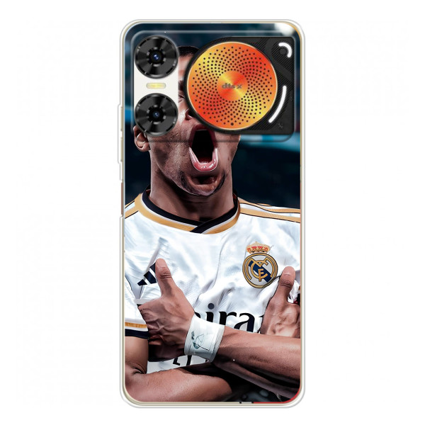 Чехол (TPU) с Футболистом на ZTE Nubia Music 2 – Гол Мбаппе