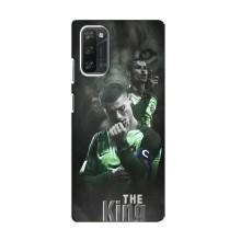 Чехол Криштиану Роналду для Blackview A100 (AlphaPrint)
