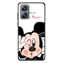 Эксклюзивный чехол для Blackview A52 (AlphaPrint - Мультяшные) (Маус Микки)