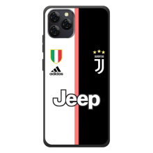 Чохли для Blackview A95 (VPrint) - Футбольні клуби (Juventus)