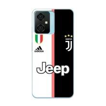 Чехлы для Blackview Oscal C70 (VPrint) - Футбольные клубы