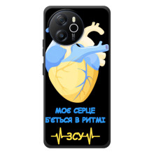 ЗСУ Чохли (TPU) для Blackview Oscal Tiger 12