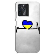 Силиконовый Чехол на Google Pixel 2 XL (Я-Украина) – Украинская кардиограмма