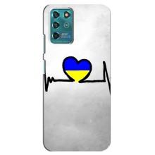 Силіконовий Чохол  на Google Pixel 2 (Я-Україна) – Українська кардіограма