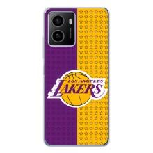 Чехлы с топовыми принтами для Пульс Плюс (Лейкерс)