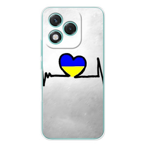 Силиконовый Чехол на Huawei Honor 400 Lite (Я-Украина) (Украинская кардиограмма)