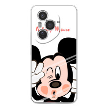 Эксклюзивный чехол для Huawei Honor 400 Pro (AlphaPrint - Мультяшные) – Маус Микки