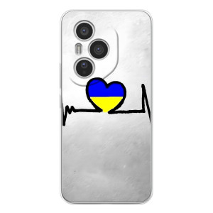 Силіконовий Чохол  на Huawei Honor 400 Pro (Я-Україна) – Українська кардіограма