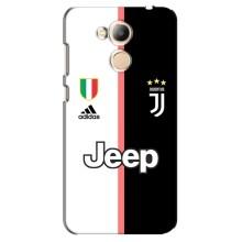 Чехлы для Huawei Honor 6c Pro (VPrint) - Футбольные клубы (Juventus)