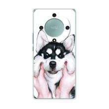 Чехол с Хаски для Huawei Honor Magic 6 Lite 5G - (AlphaPrint) (Хаски улыбака)