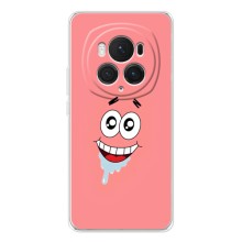 Чохли з Патріком на Huawei Honor Magic 7 Lite (Мордочка Патріка)