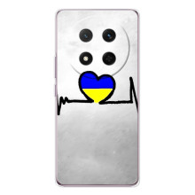 Силиконовый Чехол на Huawei Honor Magic 7 Lite (Я-Украина) (Украинская кардиограмма)