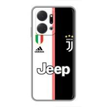 Чохли для Huawei Honor X7a (VPrint) - Футбольні клуби (Juventus)