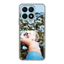 Чехлы с изображением разных животных для Huawei Honor X8a (Ежик на руках)