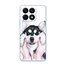 Чохол з Хаскі Huawei Honor X8a - (AlphaPrint) (Хаскі улибака)