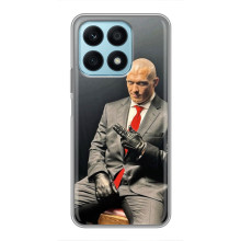 Чохол з картинкою Олександр Усик для Huawei Honor X8a – Усик (Hitman)