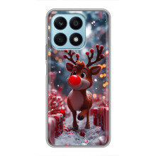 Яскравий чохол для Huawei Honor X8a з Зимові Оленята – Олень серед подарунків