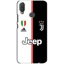 Чехлы с ТОП Футбольными клубами на Huawei P Smart Plus , Nova 3i, INE-LX1 (Juventus)