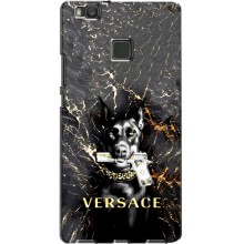 Чохли VERSACE для Хуавей П9 Лайт (PREMIUMPrint) – AlphaPrint-ген.