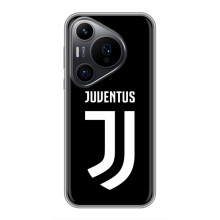Чохли для Huawei Pura 70 PRO (VPrint) - Футбольні клуби (ФК Ювентус)