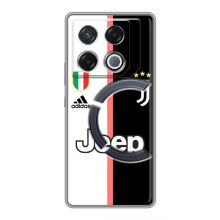 Чохли для Infinix GT 20 Pro (VPrint) - Футбольні клуби (Juventus)