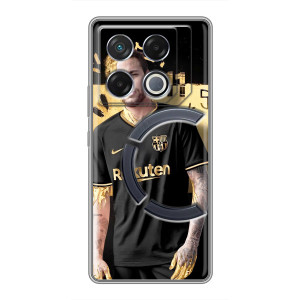 Силиконовый Чехол Infinix GT 20 Pro – Gold Neymar