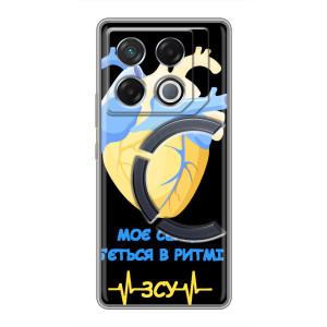 ЗСУ Чехлы (TPU) для Infinix GT 20 Pro – Ритм ЗСУ