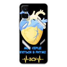 ЗСУ Чохли (TPU) для Infinix GT 30 Pro (Ритм ЗСУ)