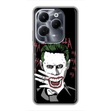 Чехлы с картинкой Джокера на Infinix Hot 40 Pro (Hahaha)