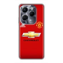 Силіконові Чохли з принтом Футбол на Infinix Hot 40 Pro – Man United
