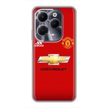 Силіконові Чохли з принтом Футбол на Infinix Hot 40 – Man United