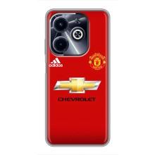 Силіконові Чохли з принтом Футбол на Infinix Hot 40i – Man United