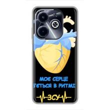ЗСУ Чехлы (TPU) для Infinix Hot 40i – Ритм ЗСУ