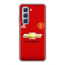 Силиконовые Чехлы принт Футбол на Infinix Hot 50 5G – Man United