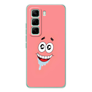 Чохли з Патріком на Infinix Hot 60 Pro (Мордочка Патріка)