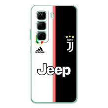 Чохли для Infinix Hot 60i (VPrint) - Футбольні клуби (Juventus)