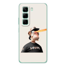 Чохли з Мавпами NFT для Infinix Hot 60i (AlphaPrint) (мавпа NFT в окулярах)