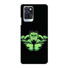 Чохли з героями Марвел Infinix Note 10 Pro (VPrint)