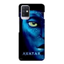 Чехлы с фильма АВАТАР для Infinix Note 10 (AlphaPrint)
