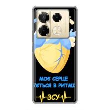 ЗСУ Чехлы (TPU) для Infinix Note 40 Pro – Ритм ЗСУ