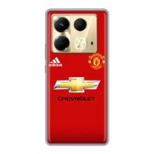 Силиконовые Чехлы принт Футбол на Infinix Note 40 – Man United