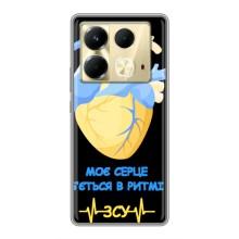 ЗСУ Чохли (TPU) для Infinix Note 40 (Ритм ЗСУ)