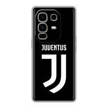 Чохли для Infinix Note 50 Pro Plus (VPrint) - Футбольні клуби (ФК Ювентус)