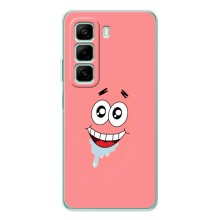 Чехлы с Патриком на Infinix Note 50 Pro Plus (Мордочка Патрика)