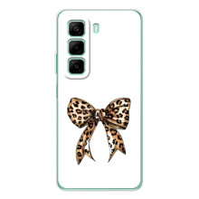 Чохол банти для Infinix Note 50 Pro Plus